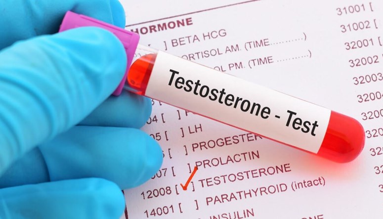The Dangers Of High Testosterone Signs Risks And Prevention Archyde 3889